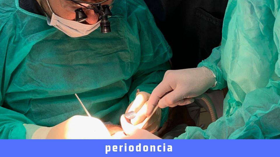 Periodoncia en ELCHE | Esteban y Cabrera | Periodontitis Elche Gingivitis